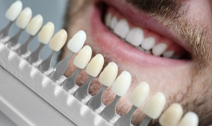how do you maintain veneers